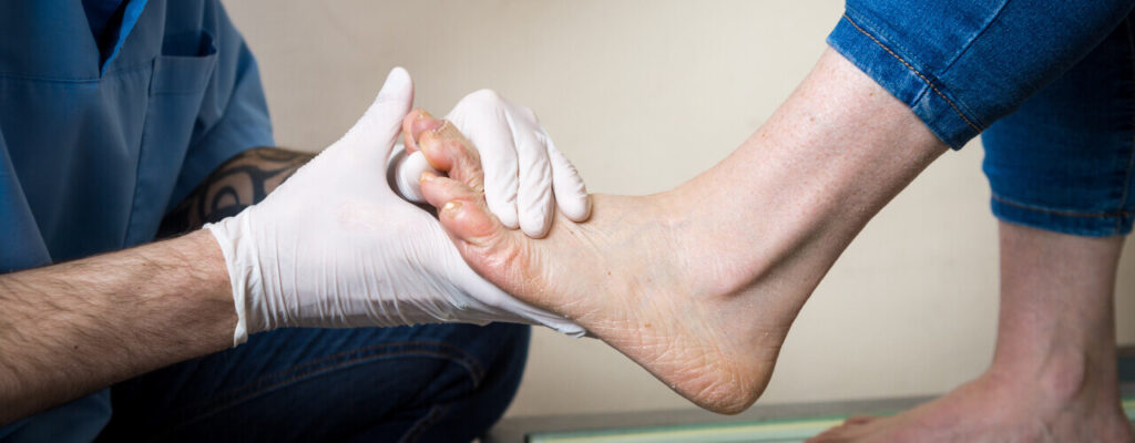 A lady Having Foot Pain